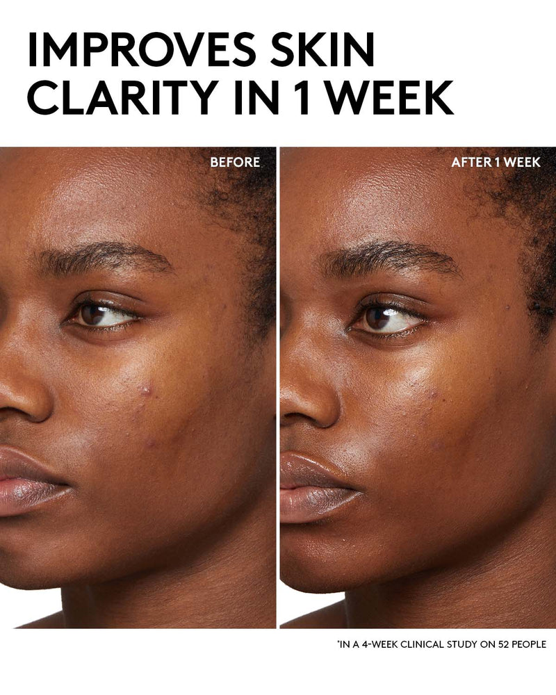 Cherry Dub BHA Toner with Salicylic Acid + Aloe Juice