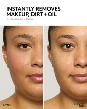 Total Cleans'r Remove-It-All Cleanser