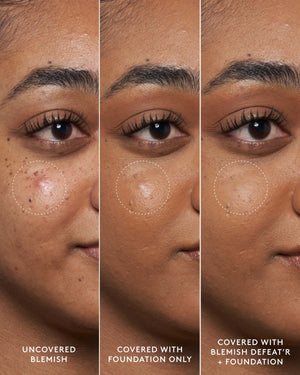 Close-up of model's medium-toned face showing an uncovered blemish, a foundation-covered blemish and a foundation and Blemish Defeat'r BHA Spot-Targeting Gel-covered blemish.