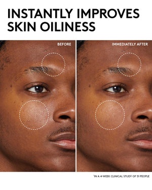 Before and after infographic picturing minimized blemishes. Copy reads instantly improves skin oiliness in a 4-week clinical study on 51 people.