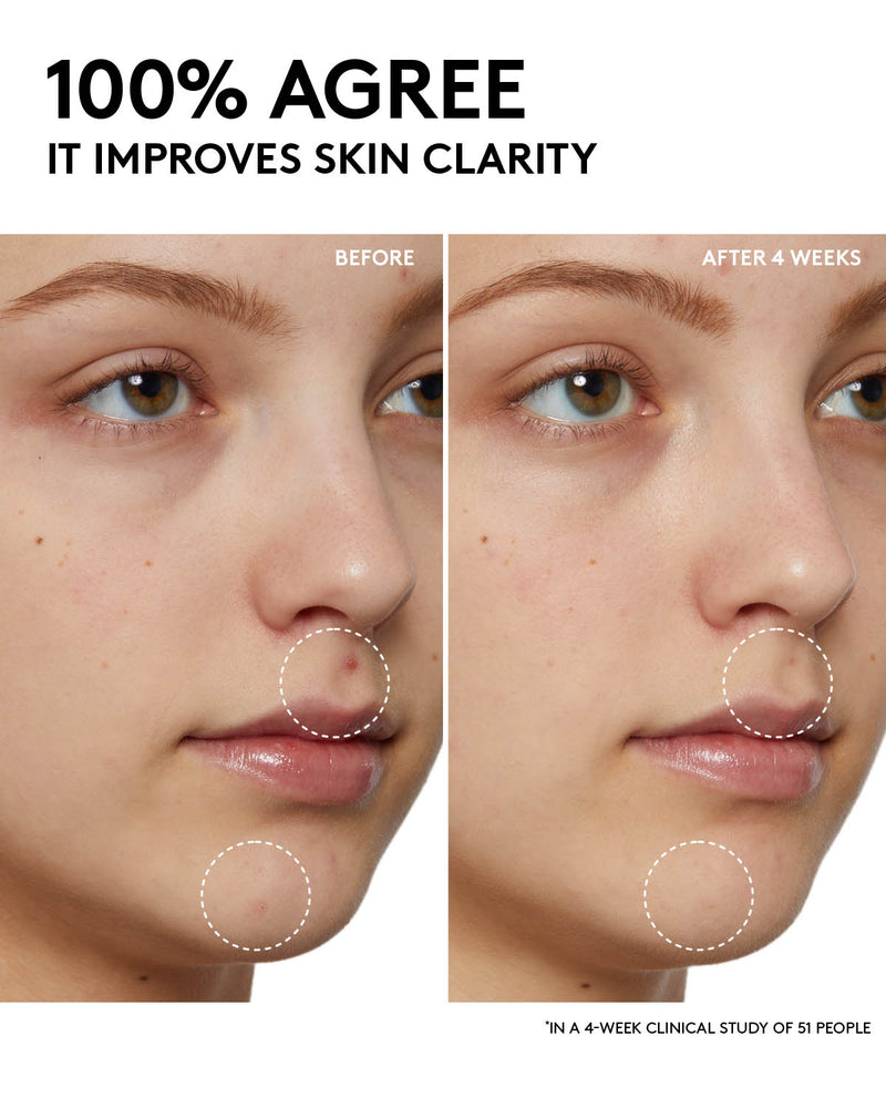 Cherry Dub Pore Purify'r Gel Cleanser with Niacinamide + Aloe Juice